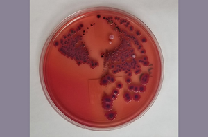 Shigella colonies on chromagar plate