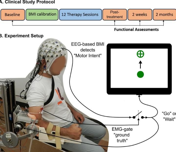 STroke Rehab