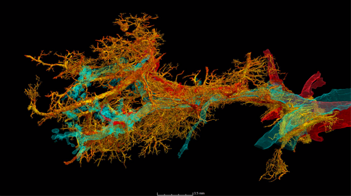 HiP-CT of the finest blood vessels and airways in the COVID-19 lung.