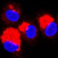 Phosphatidylethanolamine in Human Dendritic Cells Treated with Synthetic <i>F. tularensis</i> Pe Con