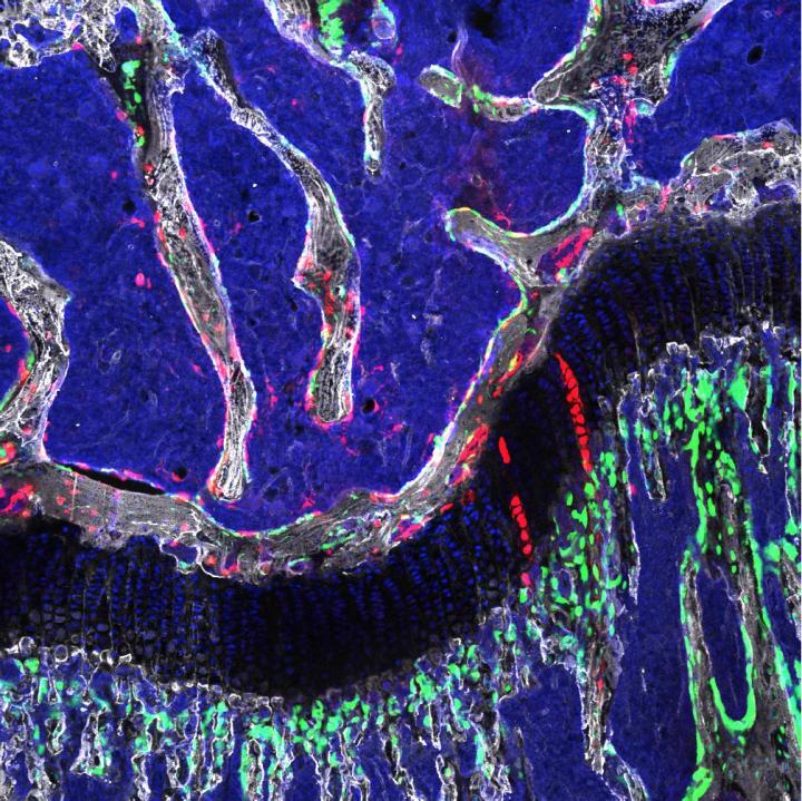 Osteochondroretricular Stem Cell