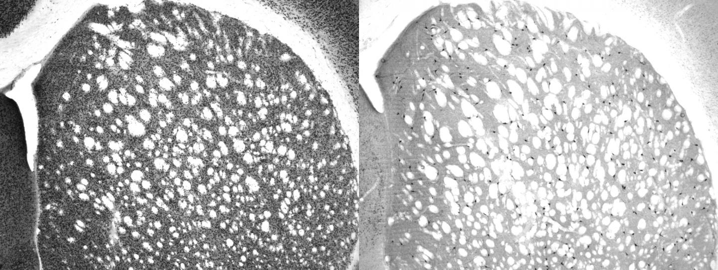 Cholinergic Interneurons