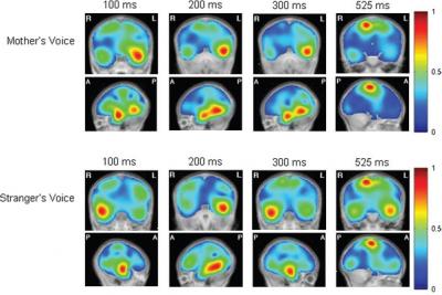 An Infant's Brain Activity Upon Hearing His Mother's Voice
