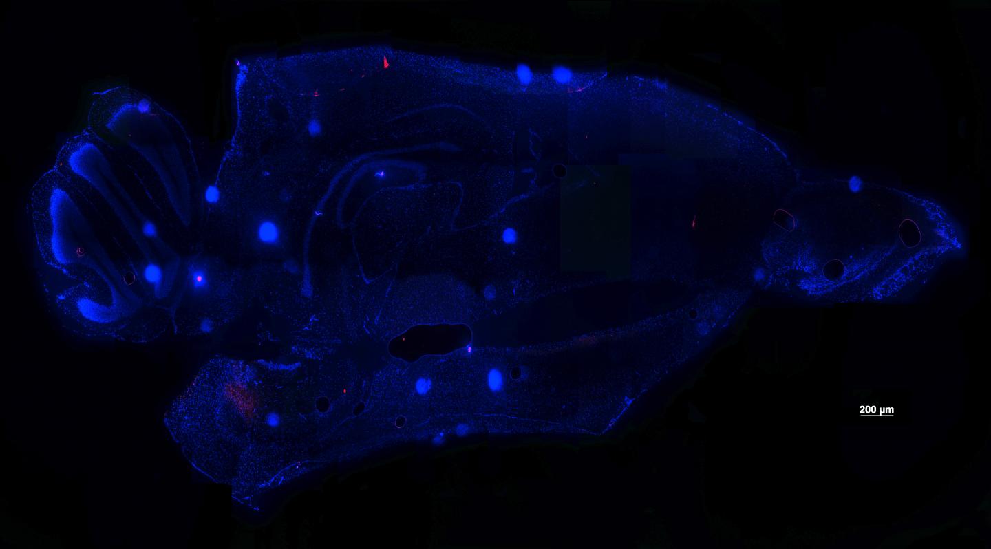 Mouse Brain Protected from Virus