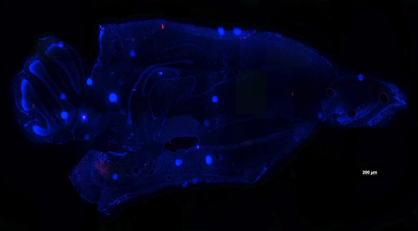 Mouse Brain Protected from Virus
