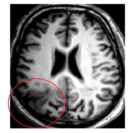 MRI Image
