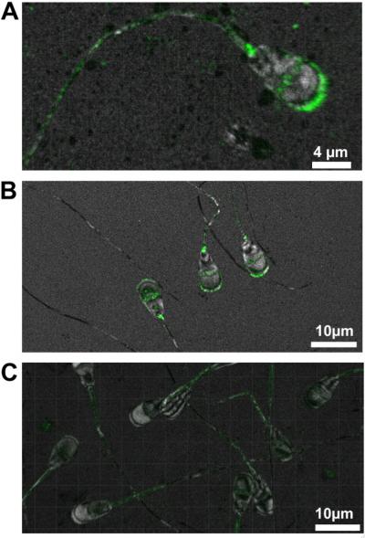 TMEM95 Protein (2 of 2)
