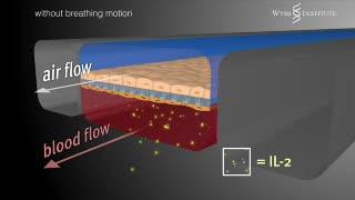 Mimicking Pulmonary Edema With a Lung-on-a-Chip (5 of 5)