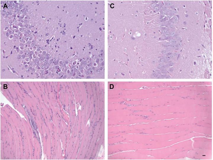 Musculature from the Posterior Rear Limb of a ZIKV-Infected Mouse