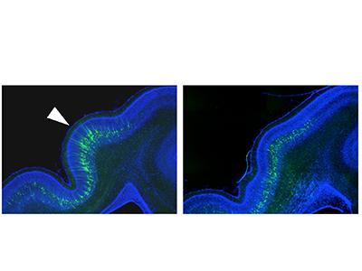 Figure 2: An Enlarged Cross-Sectional View of the Ferret Gyrus