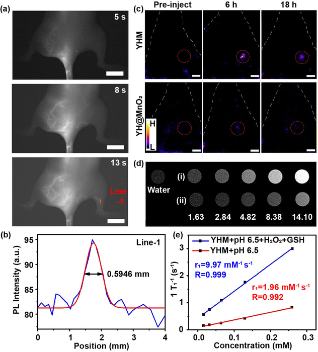 The NIR-II imaging and MRI of YHM.