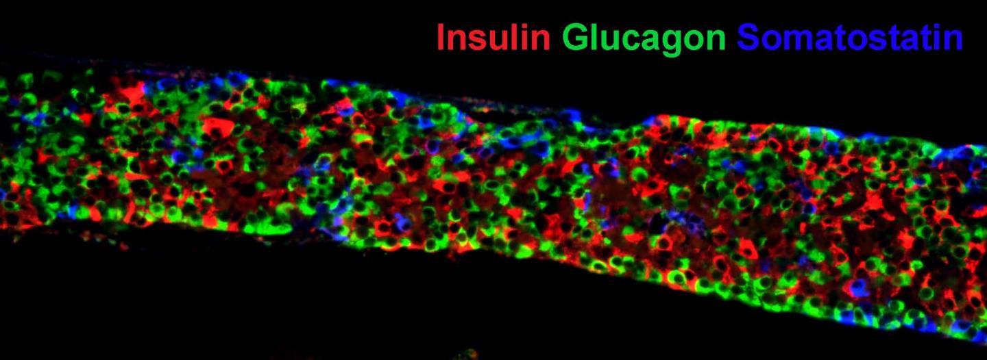 Macro-Encapsulated Pancreatic Endocrine Cells