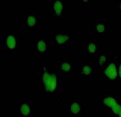 CIC-3 Positive Neurons