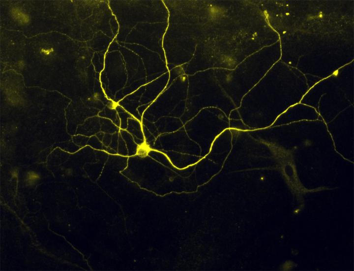 Human Pain Receptor Neurons Developed from Fibroblasts