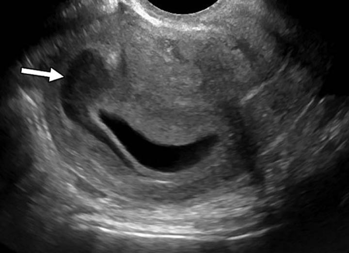 Radiologists Can Help Identify Victims of Domestic Violence