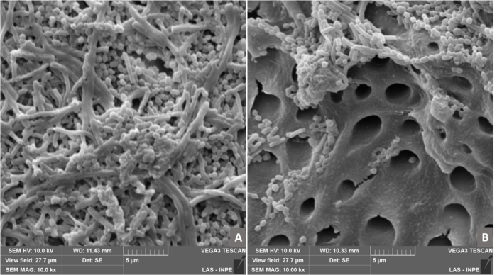 Photodynamic therapy with chlorin e-6