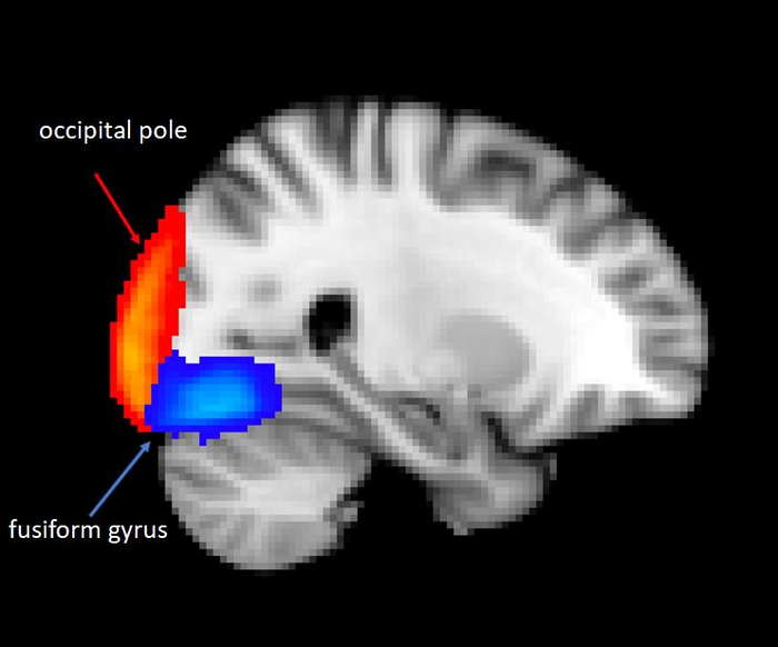 FMRI image, Capitao