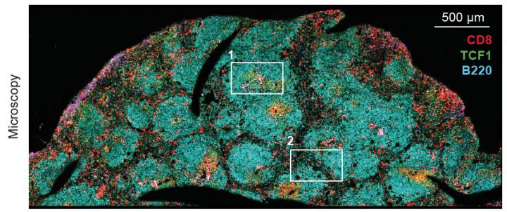 Spleen of LCMV-Infected Mouse