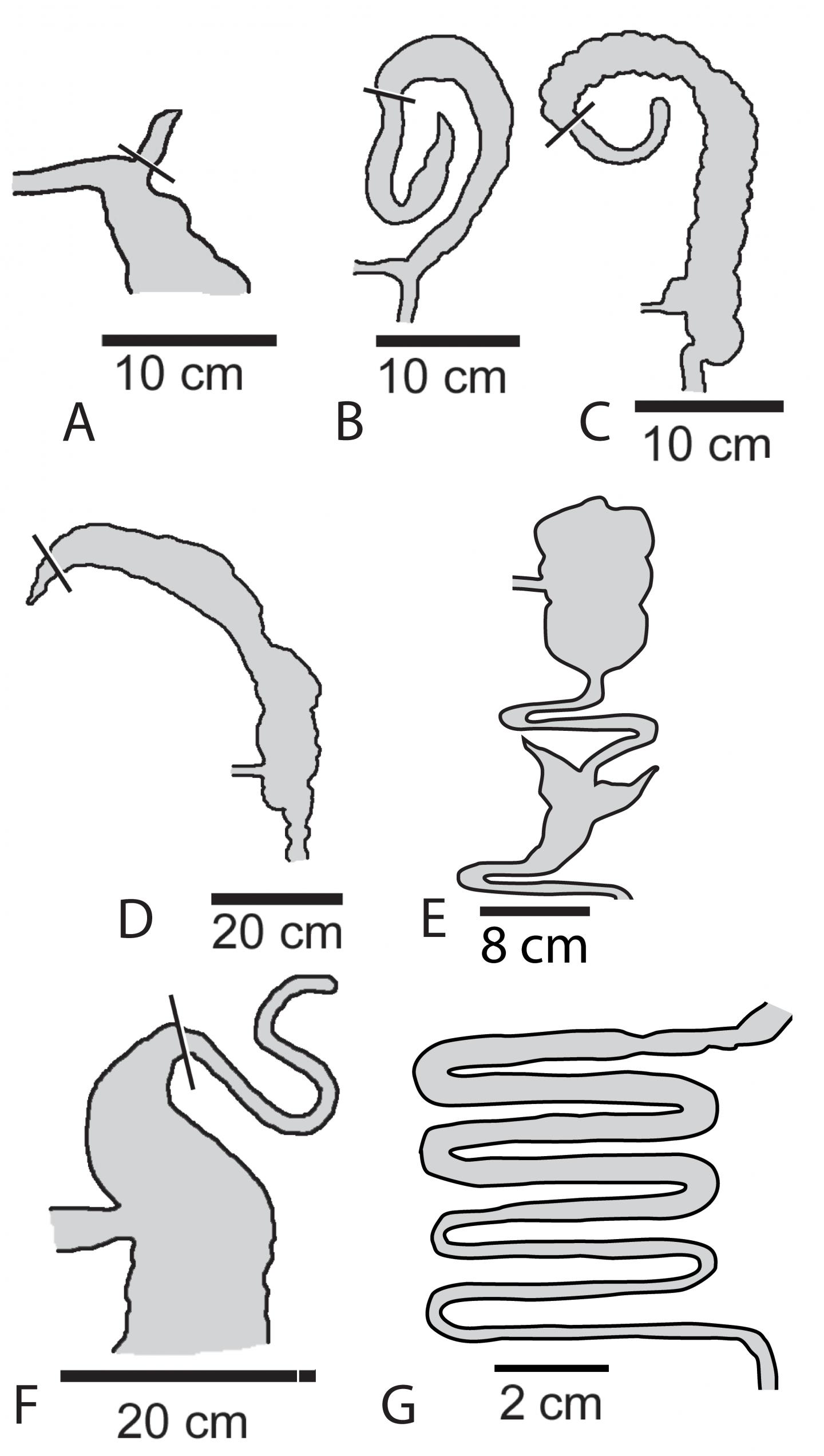 Cecal Shapes