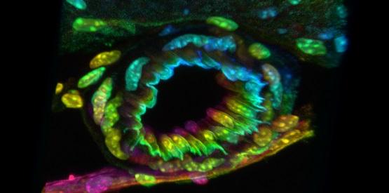 Blood Vessel Supernova Rainbow