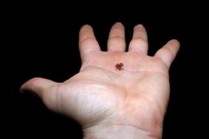 Less than 7 mm in length, this Atlantic Rainforest flea toad is the second-smallest vertebrate described in the world