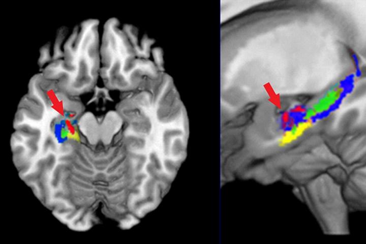 The Left Hippocampus after Learning New Scientific Information