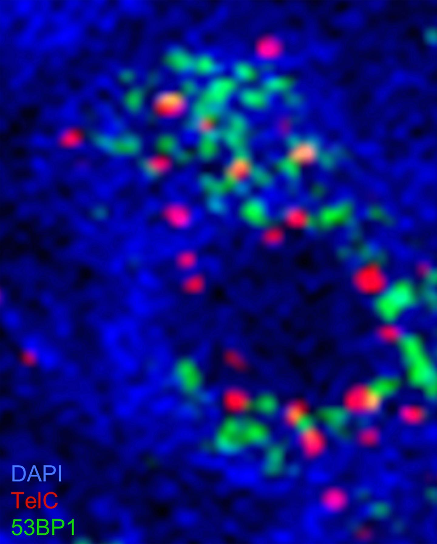 Disrupting Cancer's DNA