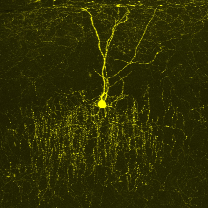 An extra gene increases inhibitory signaling in the brain of the Down syndrome mouse