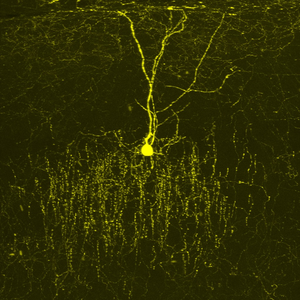 An extra gene increases inhibitory signaling in the brain of the Down syndrome mouse