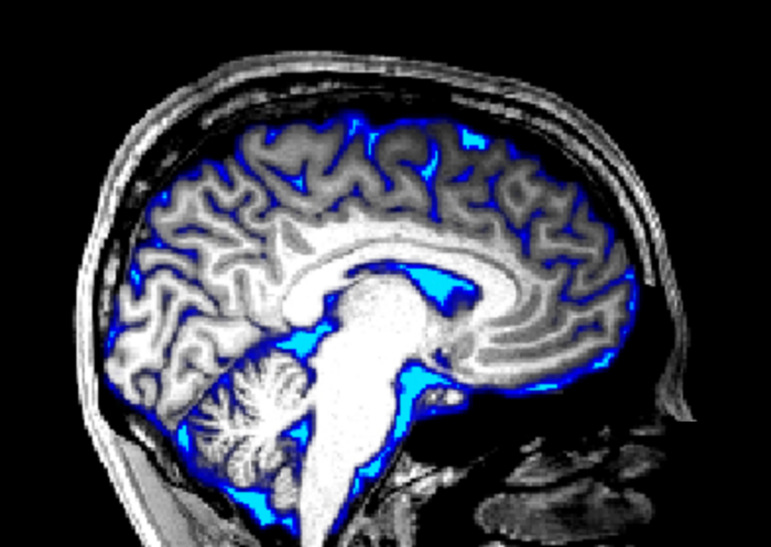 Fluid flow in the brain can be manipulated by sensory stimulation