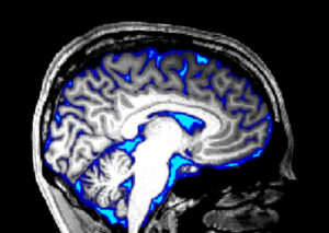 Fluid flow in the brain can be manipulated by sensory stimulation