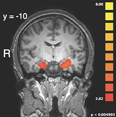 Brain Image Punishment Decision-making