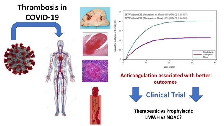 Anticoagulation Associated with Better Outcomes in Hospitalized Patients