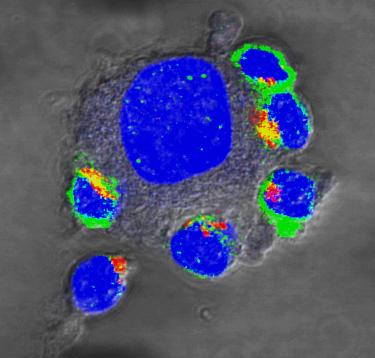 Neuer Ansatz zur T-Zell-Therapie gegen Krebs