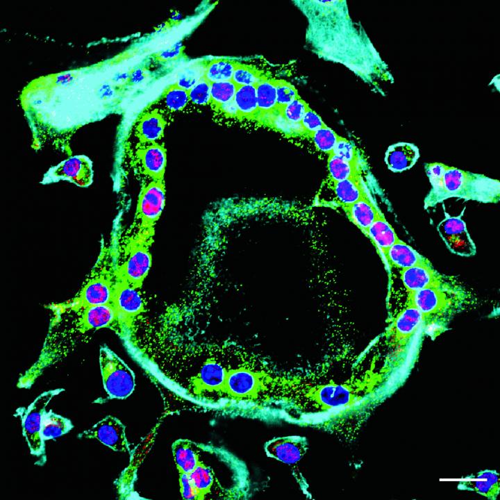Hampering Bone Breakdown Prote [IMAGE] EurekAlert! Science News Releases