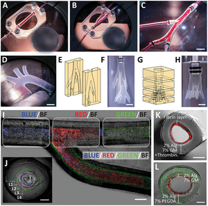 Freestanding vascular constructs recapitulating anatomically relevant geometries and multilayered structure of a blood vessel.