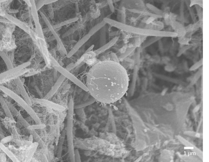 Blastocystis ST4 cell (spherical structure) in close contact  with bacteria (rod shapes) within the gut of laboratory models