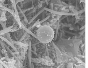 Blastocystis ST4 cell (spherical structure) in close contact  with bacteria (rod shapes) within the gut of laboratory models