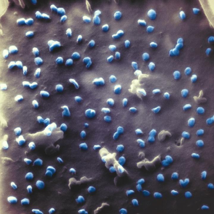 Coronaviren, aufgenommen mit einem Heliumionen-Mikroskop