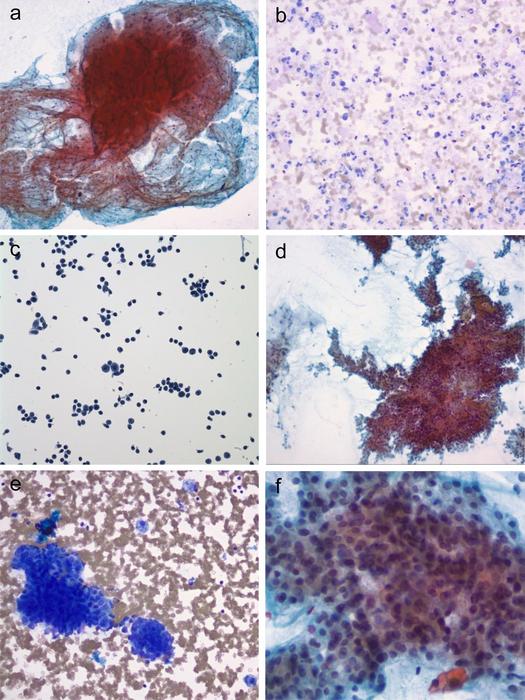 Representative examples in each diagnostic category of the MSRSGC