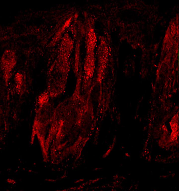 TRPM4 in Taste Cells