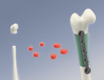 Segmental Additive Tissue Engineering (SATE)