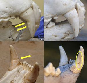 Snare damage to teeth