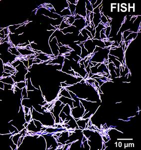 FISH: Fluorescence microscopy of Taurinivorans muris in pure culture