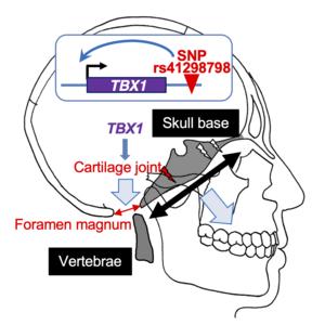 A regulatory variant impacting TBX1 expression contributes to the morphology at the base of the skull.