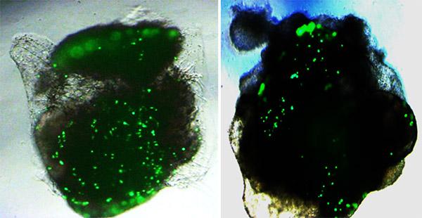 Brian and Lung Organoids, University of California San Diego