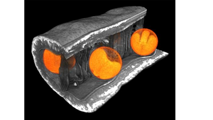 The image depicts a virtual slice through a Brassica napus silique, showing the spatial arrangement of the seeds (in orange). The image was produced using magnetic resonance imaging (MRI).