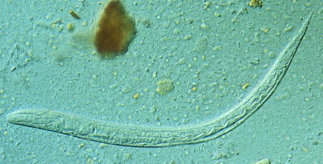 One third of Cambodians Infected with threadworm, Study Finds