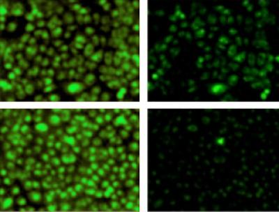 Promising Drug Target for Cystic Fibrosis