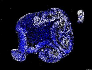 Alzheimer's disease mutant organoid